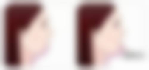 海口慢拾光医疗美容诊所庄姮医生根管治疗技术怎么样？