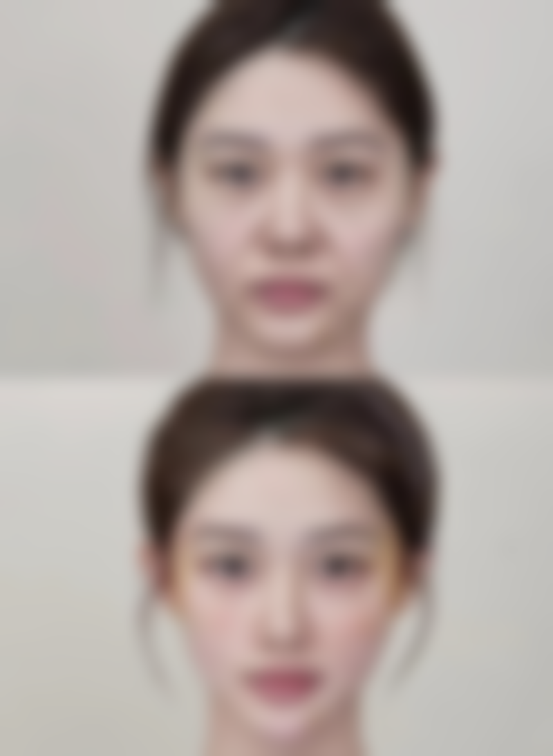 沈阳和平斯美诺整形医疗美容诊所口碑评价怎么样？