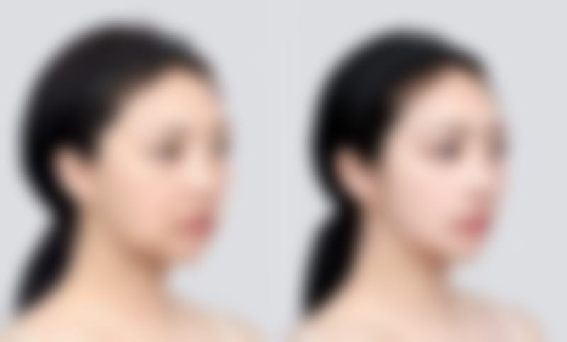 兰州雍禾医疗美容诊所怎么预约