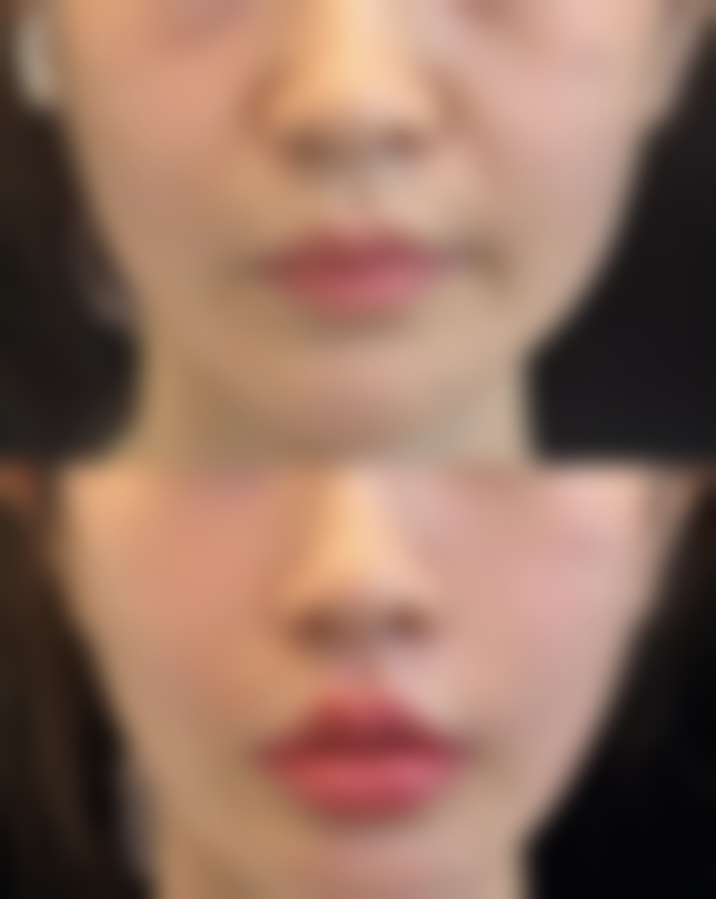 威海可人整形美容机构郭杰医生医生擅长项目