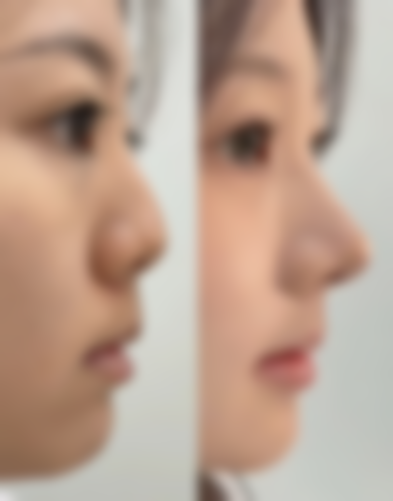 眉山市人民医院医学美容整形科正规吗？