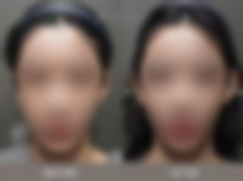 昆明市第一人民医院甘美医院整形美容科口碑评价怎么样？