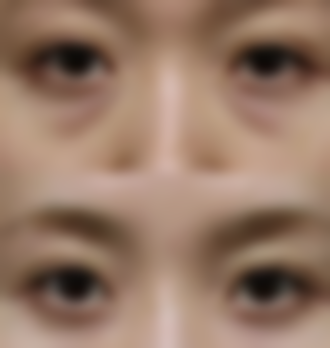 什么产品去疤成效好？