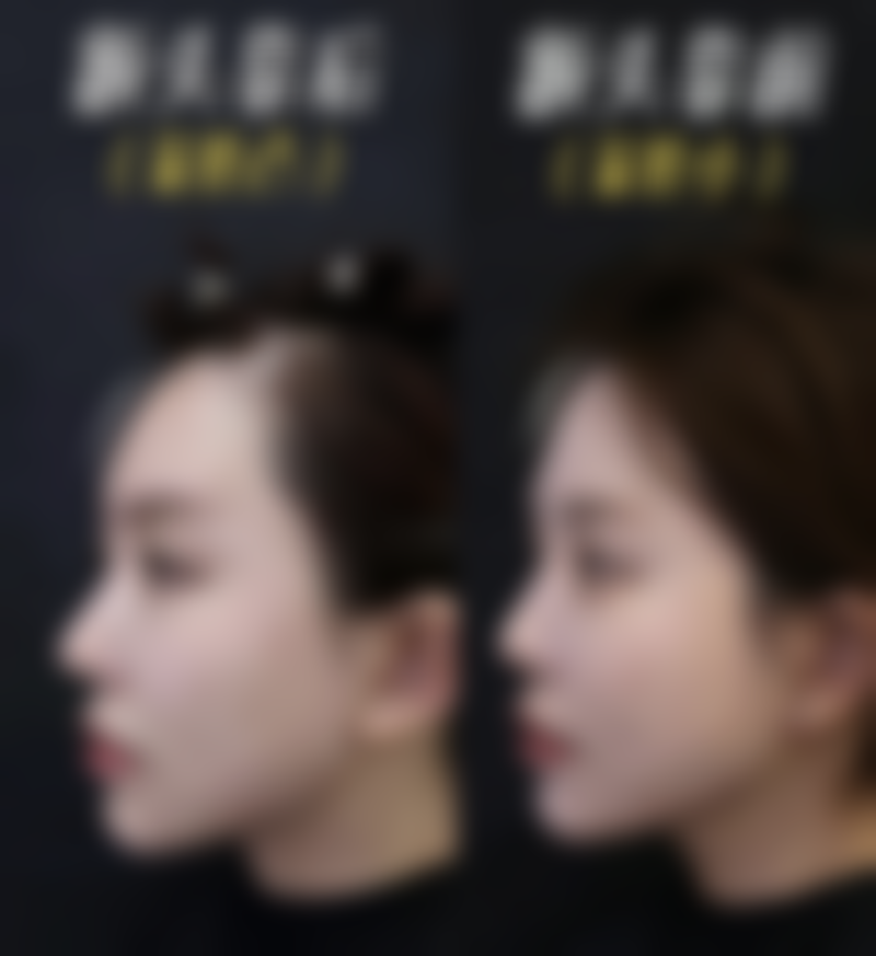 jelim整形外科正规吗？