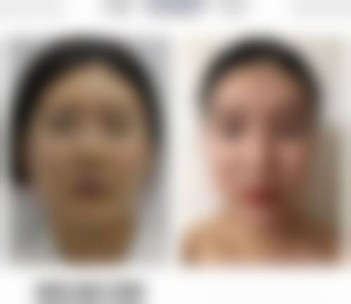 韩国bonps整形外科songin - gook医生社会职称