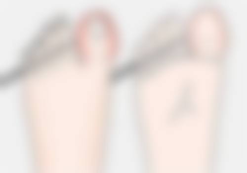 提眉手术的修复期有多长？