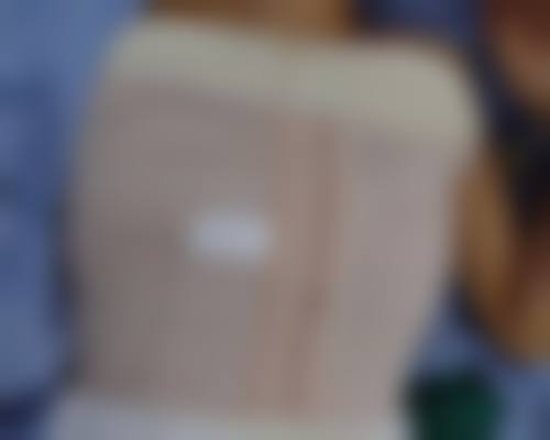 哪些人适合做提眉手术来改善眼袋和鱼尾纹呢？