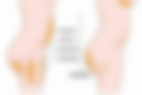 西安美托邦医疗美容口碑评价怎么样？