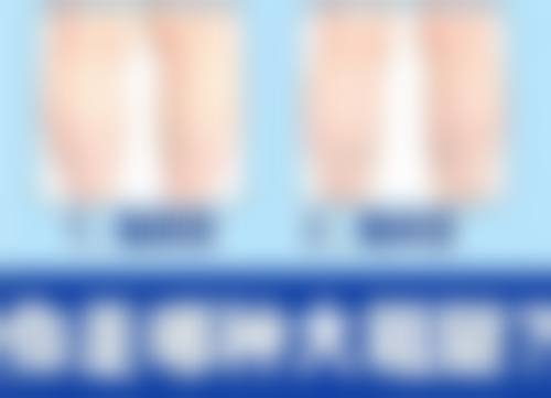 保定市竞秀区蓝山医疗美容医院卢闯医生患者评价