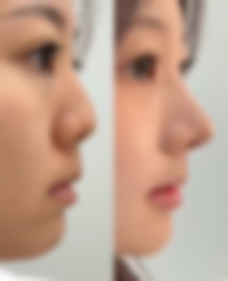 深圳名媛汇医疗美容门诊部口碑评价怎么样?