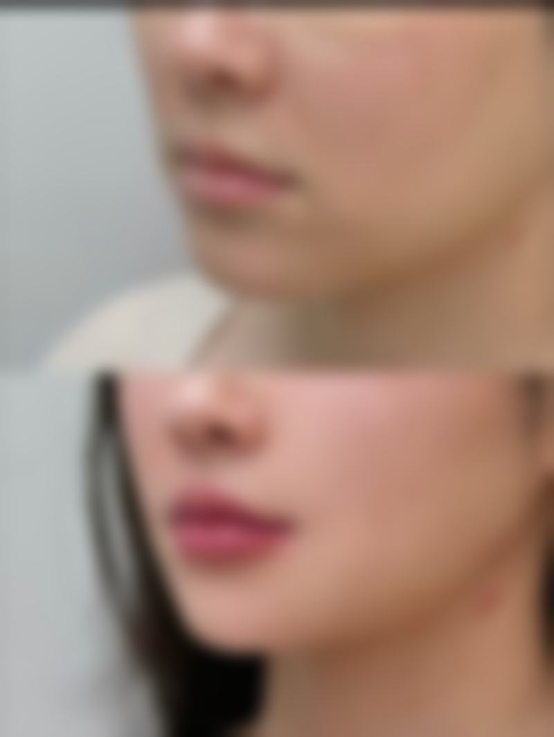 大同三医院整形美容科正规吗？