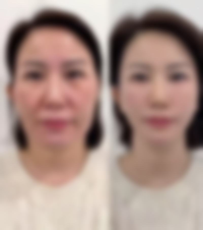 海口琼山梁丽萍医疗美容诊所正规吗?