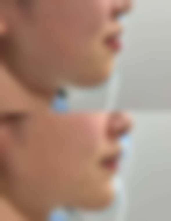 广西国内外壮医医院(整形外科)怎么预约