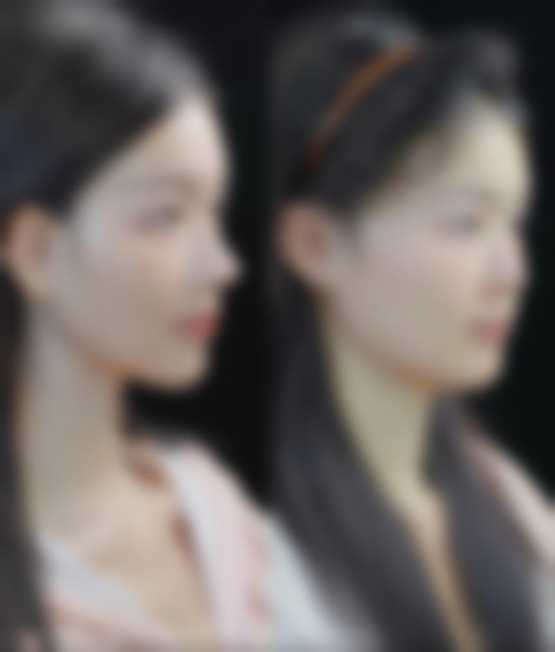 长沙伊百丽医疗美容门诊部杨志波医生患者评价