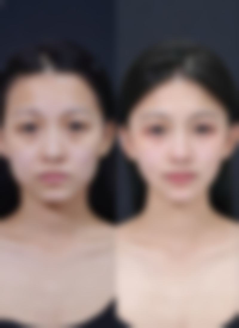 Wiz&美整形医院收费价格表