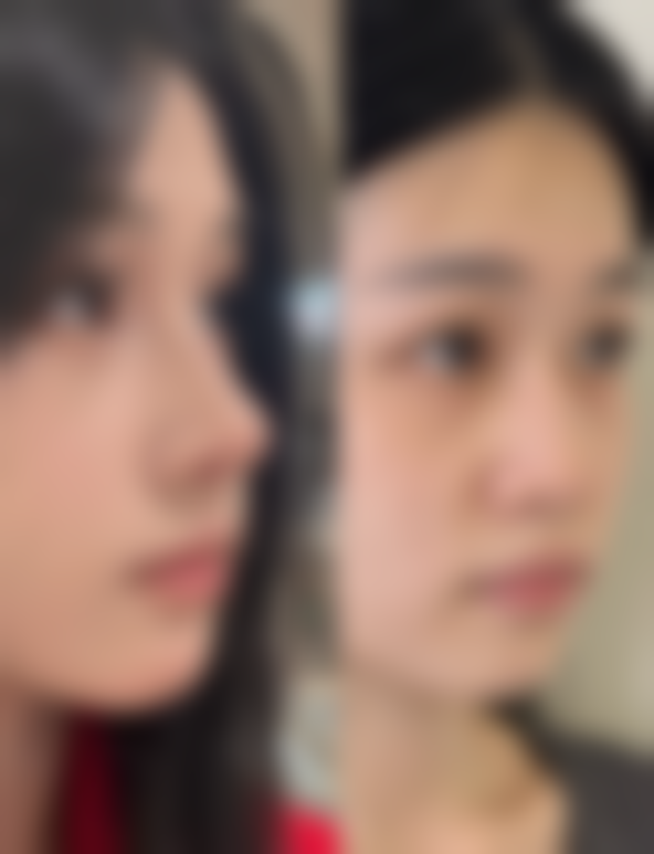 武汉逆龄医疗美容门诊部蒋有华医生鼻部综合整形技术怎么样?