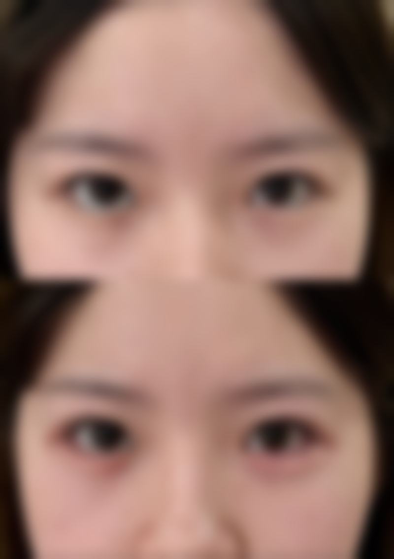 长沙伊百丽医疗美容门诊部杨志波医生擅长项目