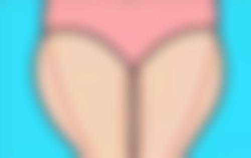 面部吸脂术后如何进行加压塑形与肿胀管理？