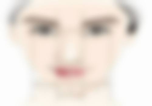 面部吸脂的术后处理是怎样的？