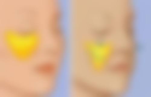 盘锦京韩美容整形医院怎么预约