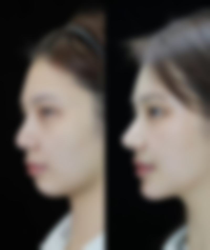 合肥市第二人民医院(整形外科)口碑评价怎么样？