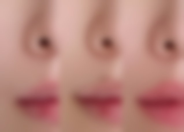 术前术后有哪些核心注意事项？