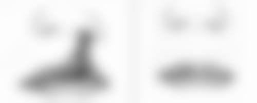 激光溶脂和吸脂手术在选择医疗机构和医生方面有什么要求？