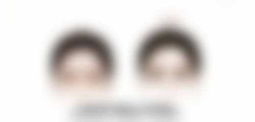 在这五大医院割双眼皮的价格如何？