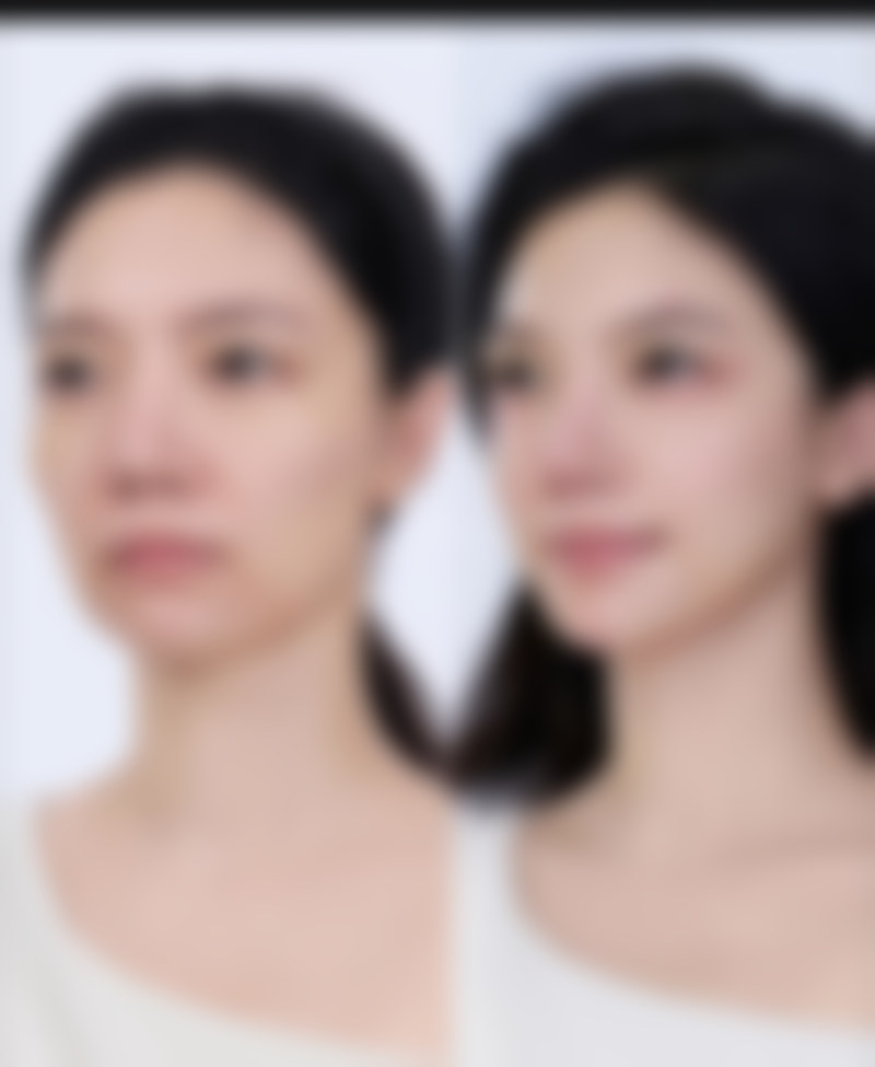 郑州诺颜一生医疗美容门诊部高雪莹医生擅长项目