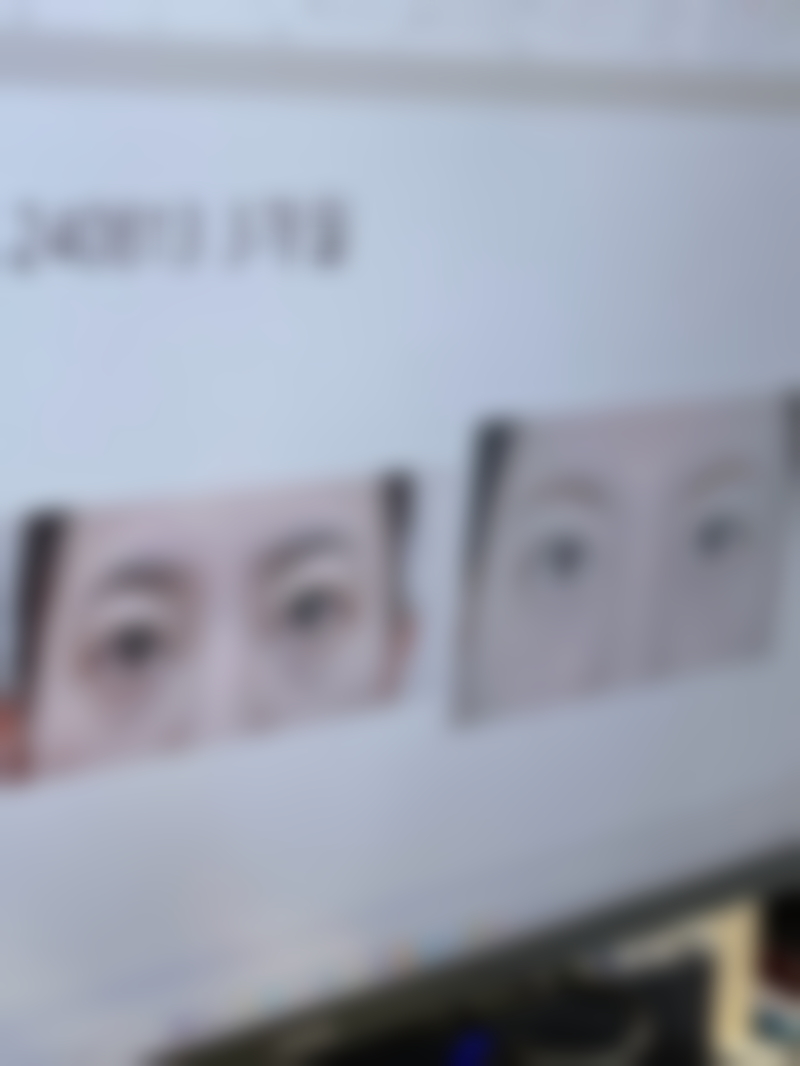 该如何选择激光溶脂和吸脂手术呢？