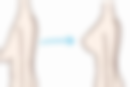 上海慕正医疗美容整形医院正规吗？