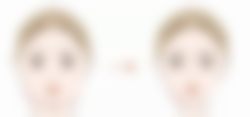 太原甜橙整形医院正规吗?