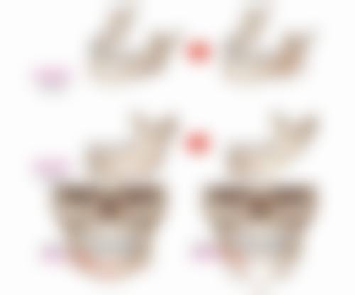 做了隆胸手术吃什么东西恢复的快？这5种食物助你快速恢复！它们分别是哪些呢？ 