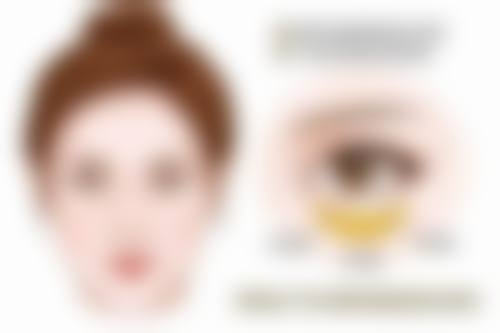 哪些人不适合做超声波祛眼袋?