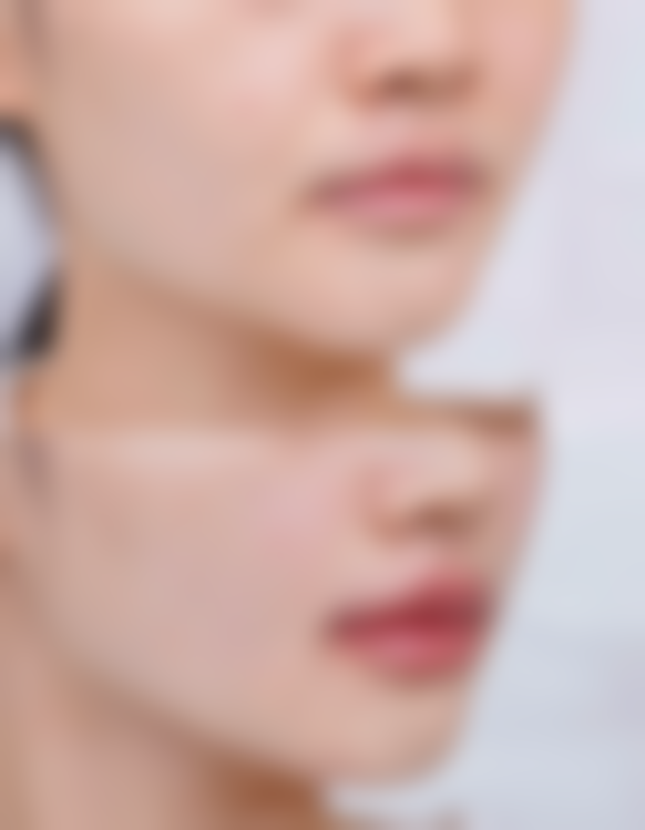 超声波祛眼袋有效果吗？揭秘真实效果与专家建议，做一次能维持多久？有副作用吗？ 