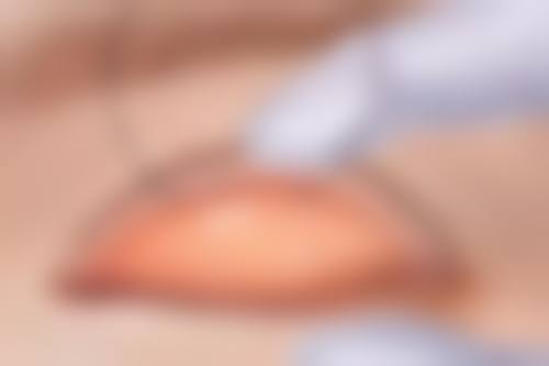 佛山花禧新医疗美容诊所口碑评价怎么样?