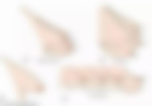 深圳王狮传奇整形医院正规吗?