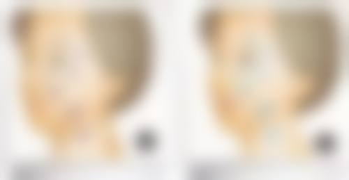 深圳王狮传奇整形医院口碑评价怎么样?