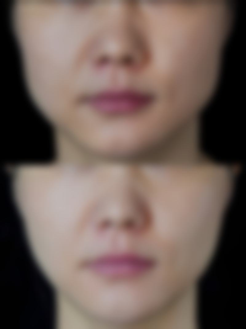 运城新华医疗美容诊所正规吗?