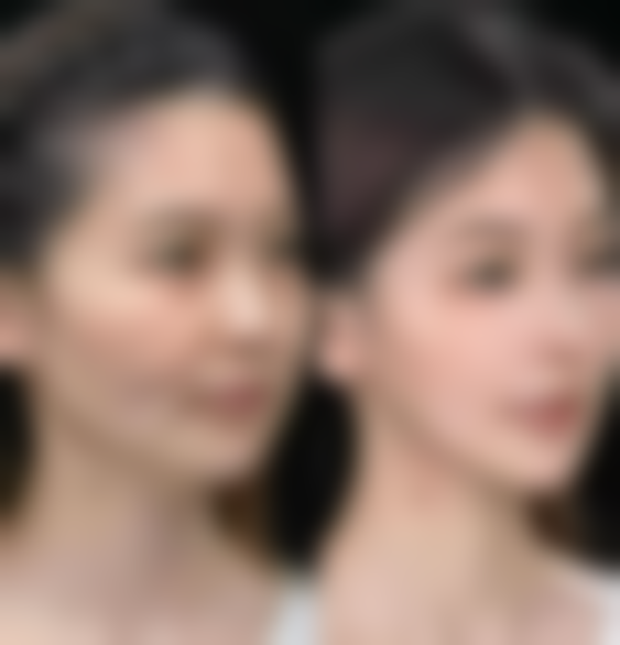 哈尔滨禾力康医疗美容医院赵金阳医生预约挂号指南