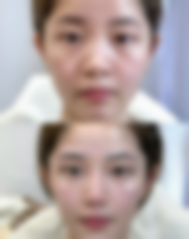 攀枝花大华医学美容医院刘永洪医生收费价格