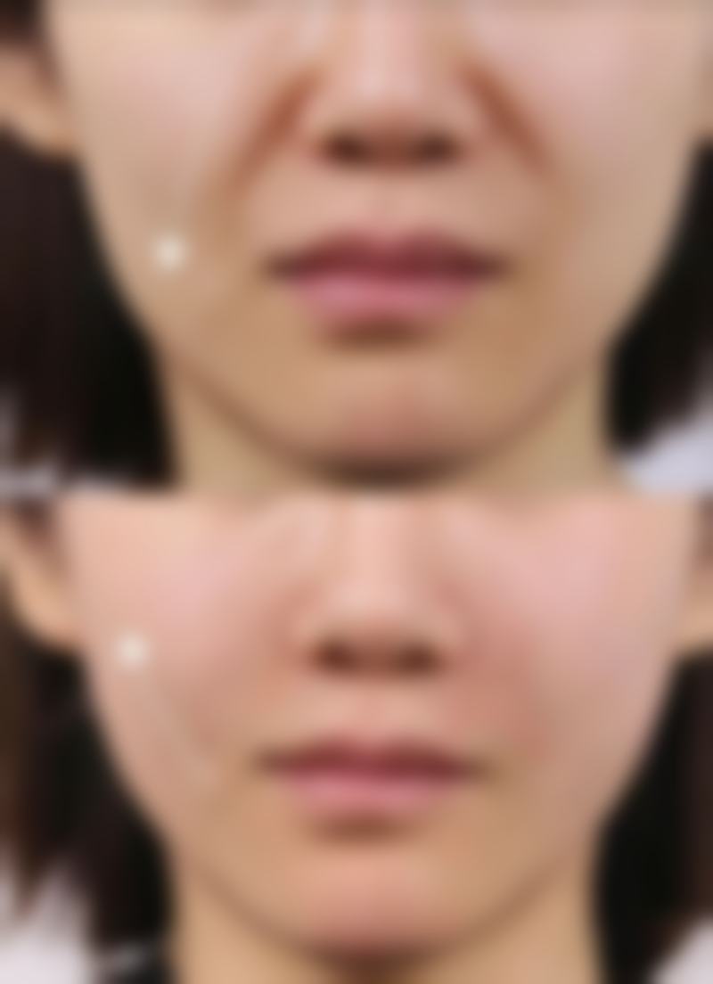 沧州水芙蓉医疗美容诊所怎么预约