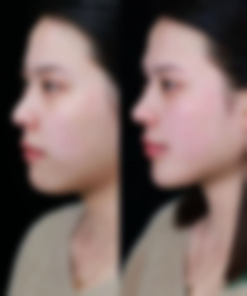 浙江省人民医院冀宇医生擅长项目