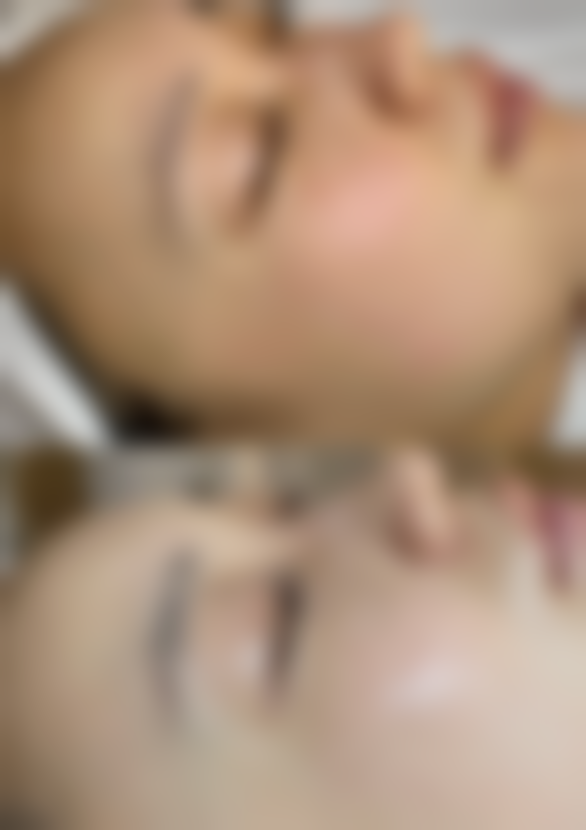 佛山花禧新医疗美容诊所怎么预约