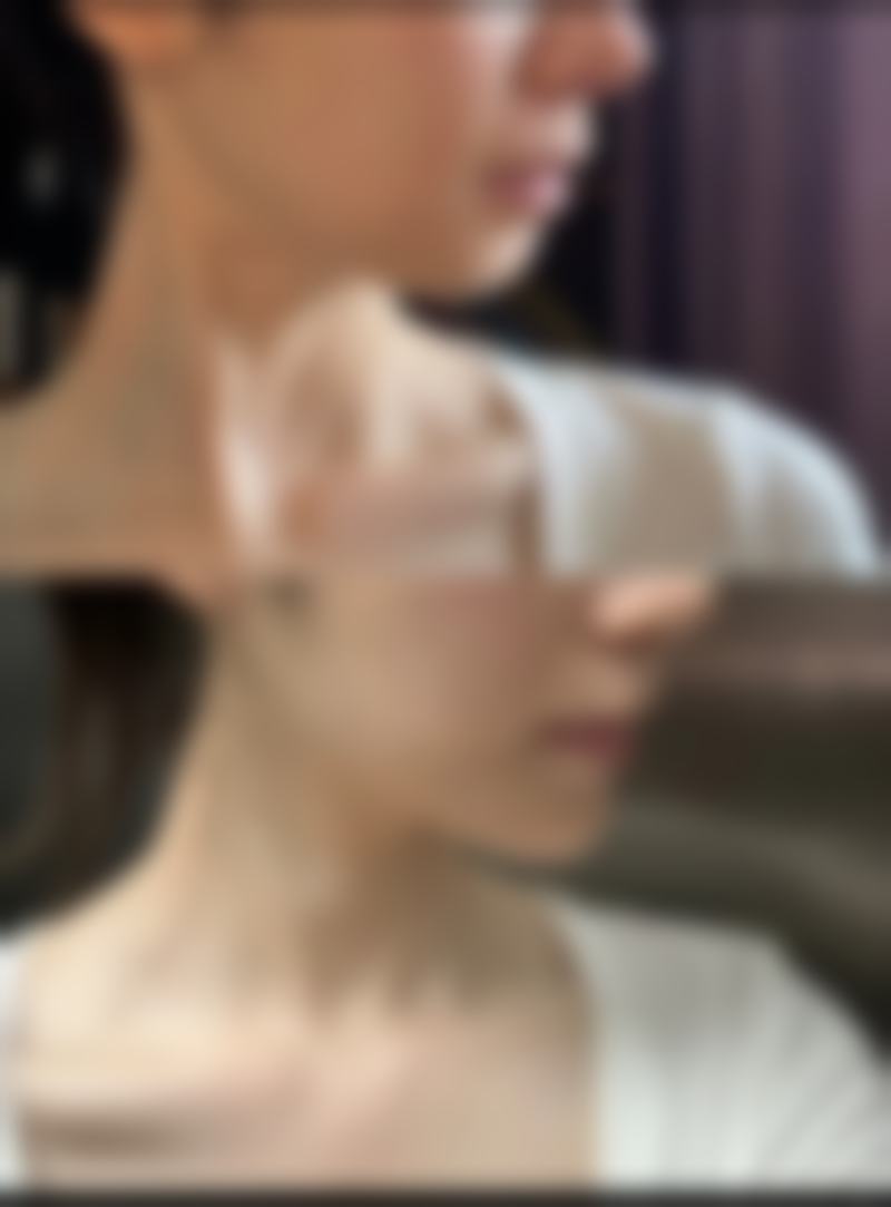 哈尔滨禾力康医疗美容医院赵金阳医生擅长项目