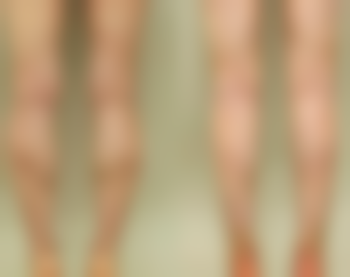 选择去眼袋产品时要注意什么？