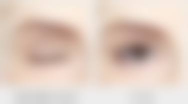 斯楼斌提出的三类修复方式是怎样的呢？