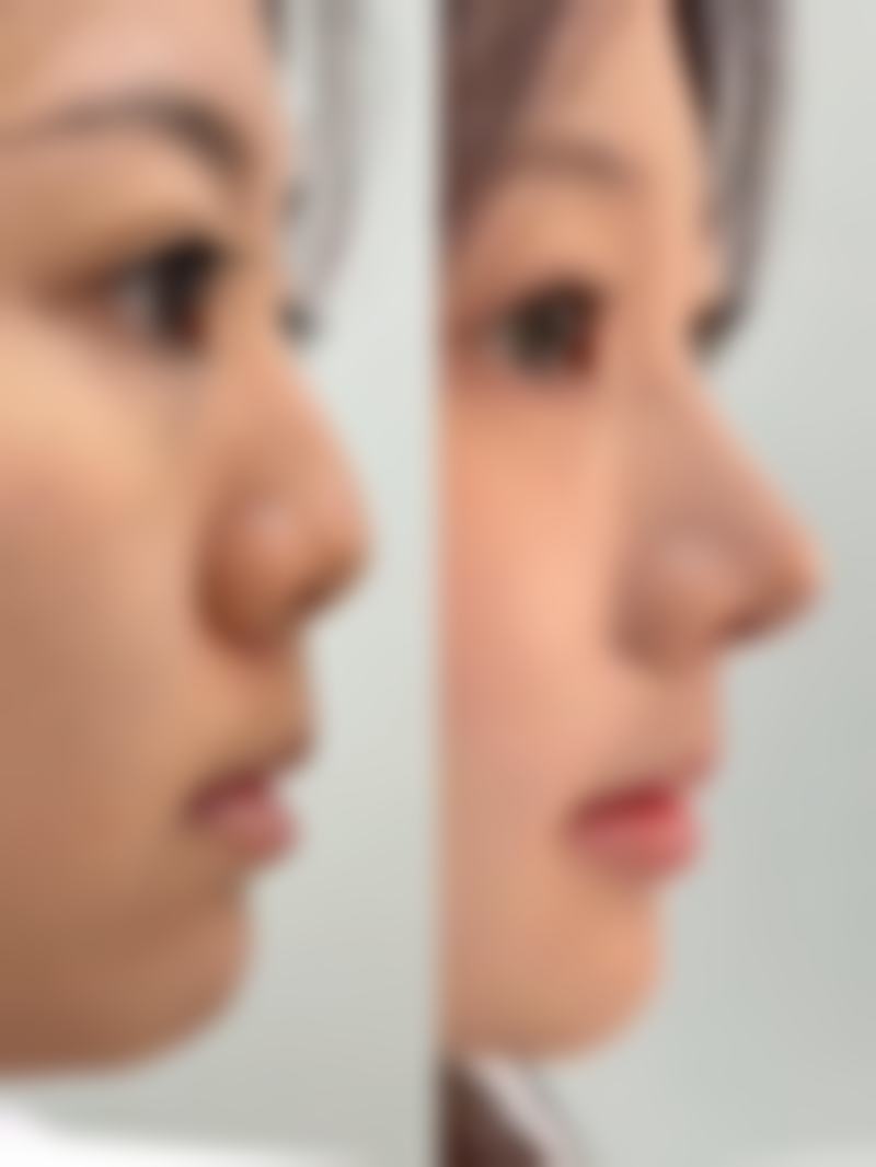 内蒙古包钢医院整形外科正规吗?