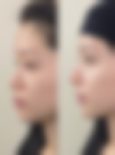 洛阳生殖医学专科医院整形科刘社红医生擅长项目