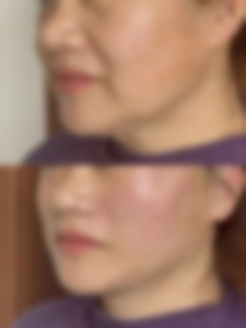 济南市艺星整形美容医院有限公司杨季涛医生预约挂号指南